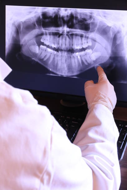 Best Emergency Dentist for Knocked-Out Tooth in Santa Barbara, CA